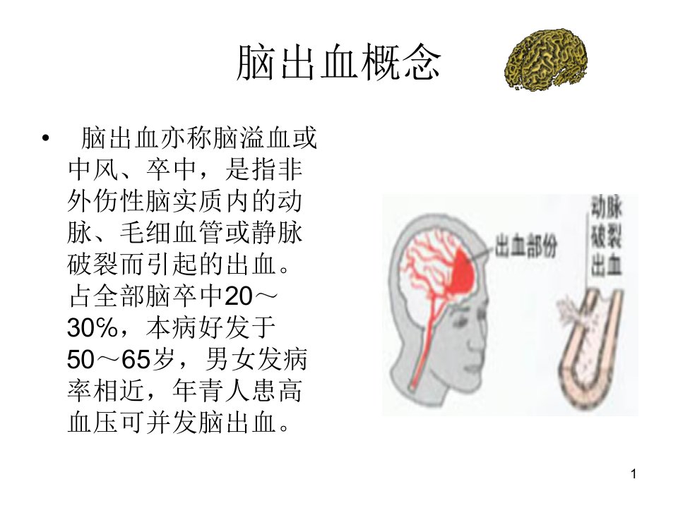 月份护理查房脑出血