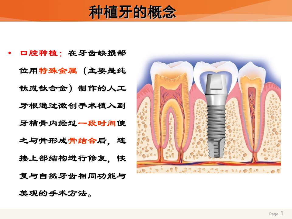 《种植牙基础》PPT课件