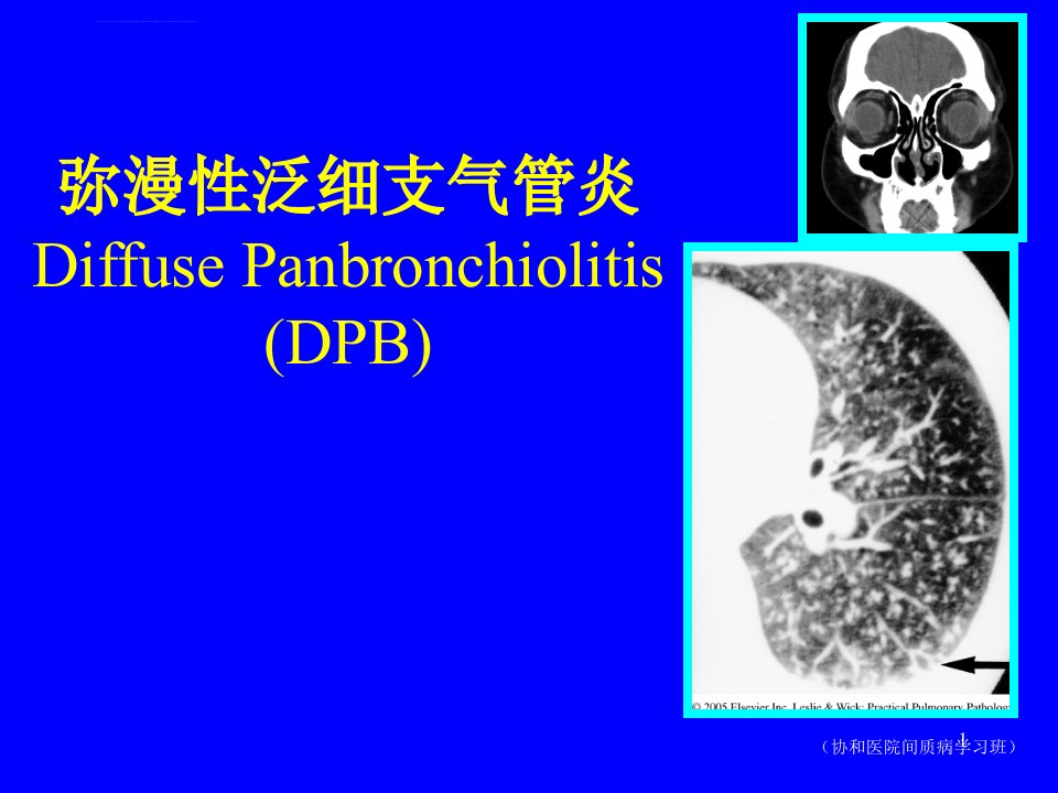 弥漫性泛细支气管炎课件