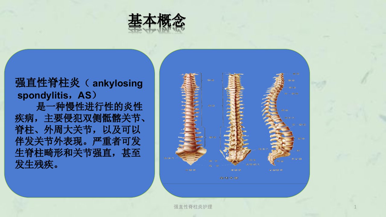 强直性脊柱炎护理ppt课件