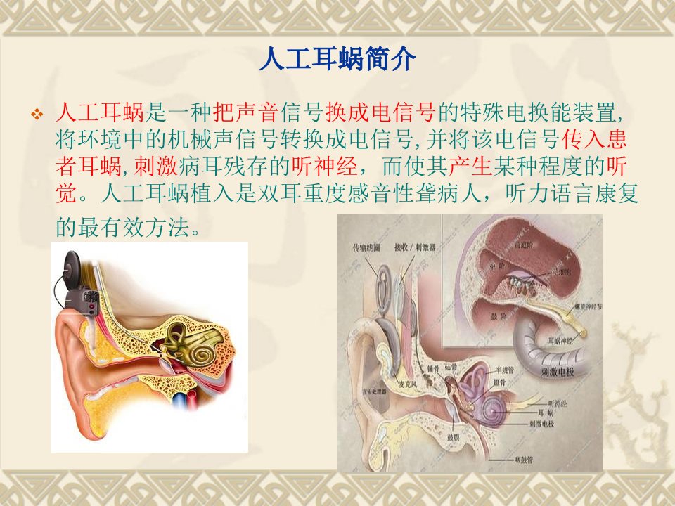 儿童人工耳蜗植入术的简介及麻醉要点赵献亮