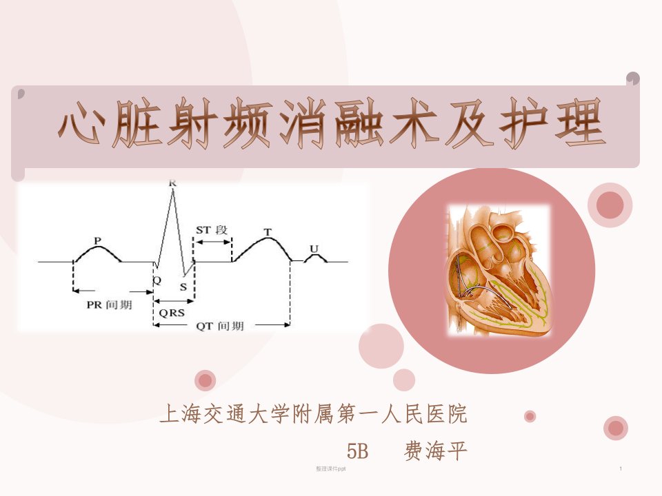 《射频消融术的护理》PPT课件