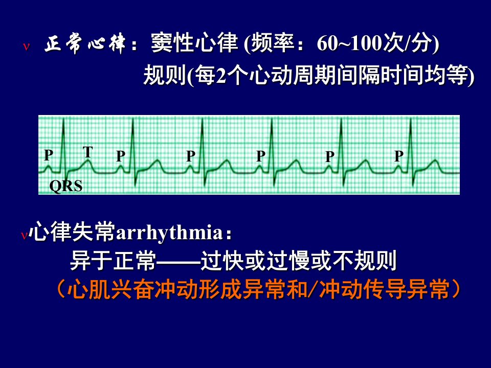 抗心律失常药