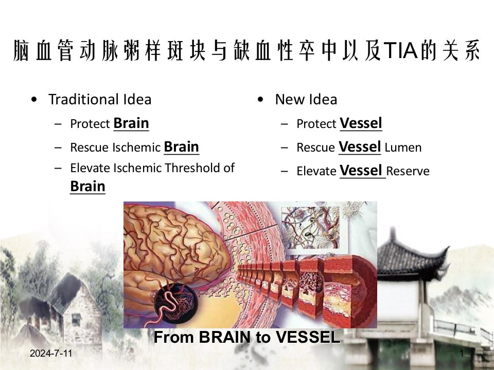 从实践和循证看动脉粥样硬化斑块患者的他汀治疗