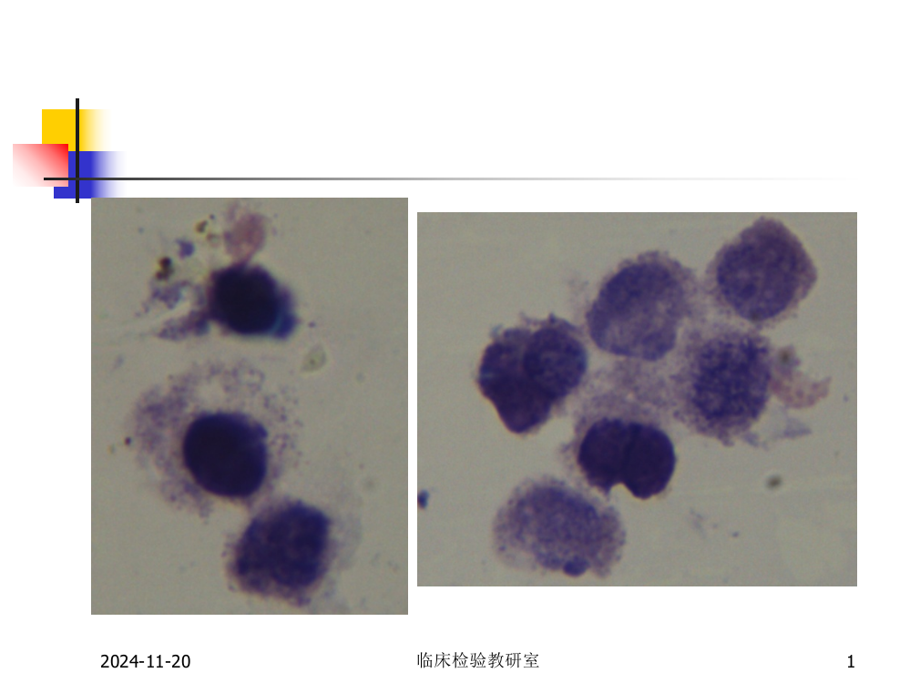 脱落细胞学检查1检验新-PPT幻灯片