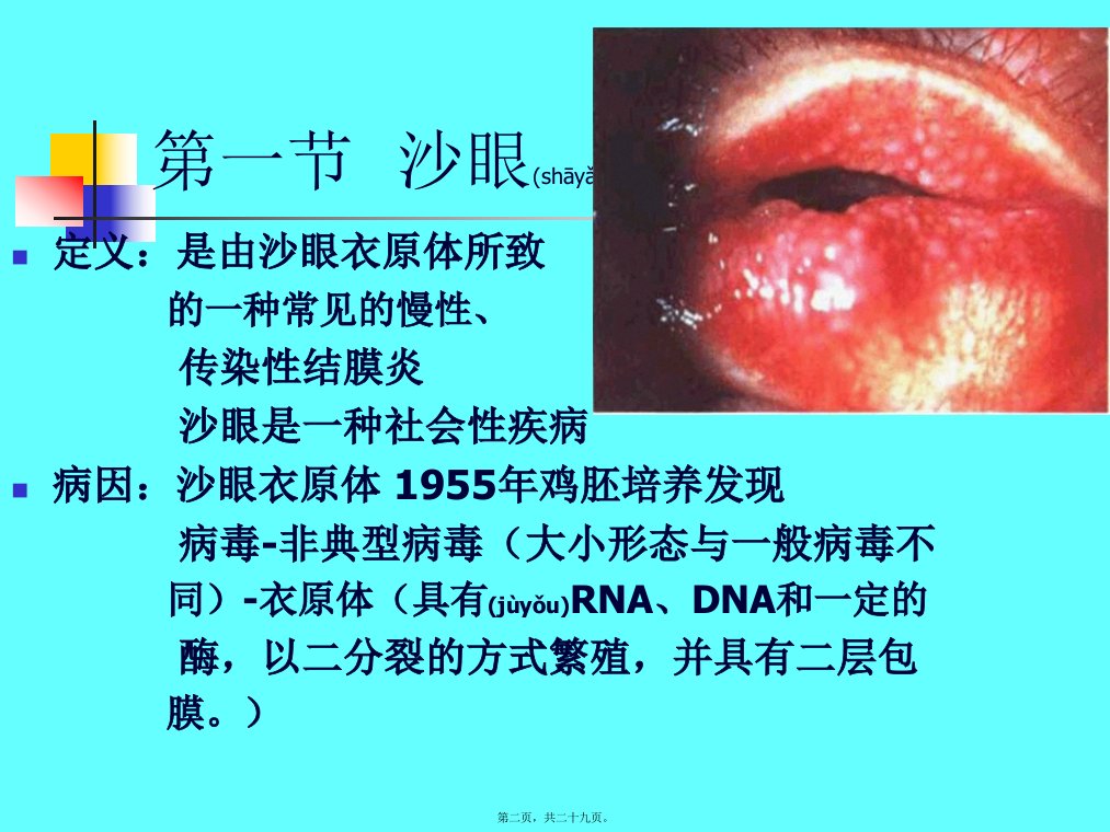 医学专题滤泡角膜血管翳