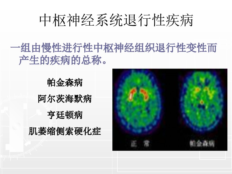 14抗中枢神经系统退行性疾病药