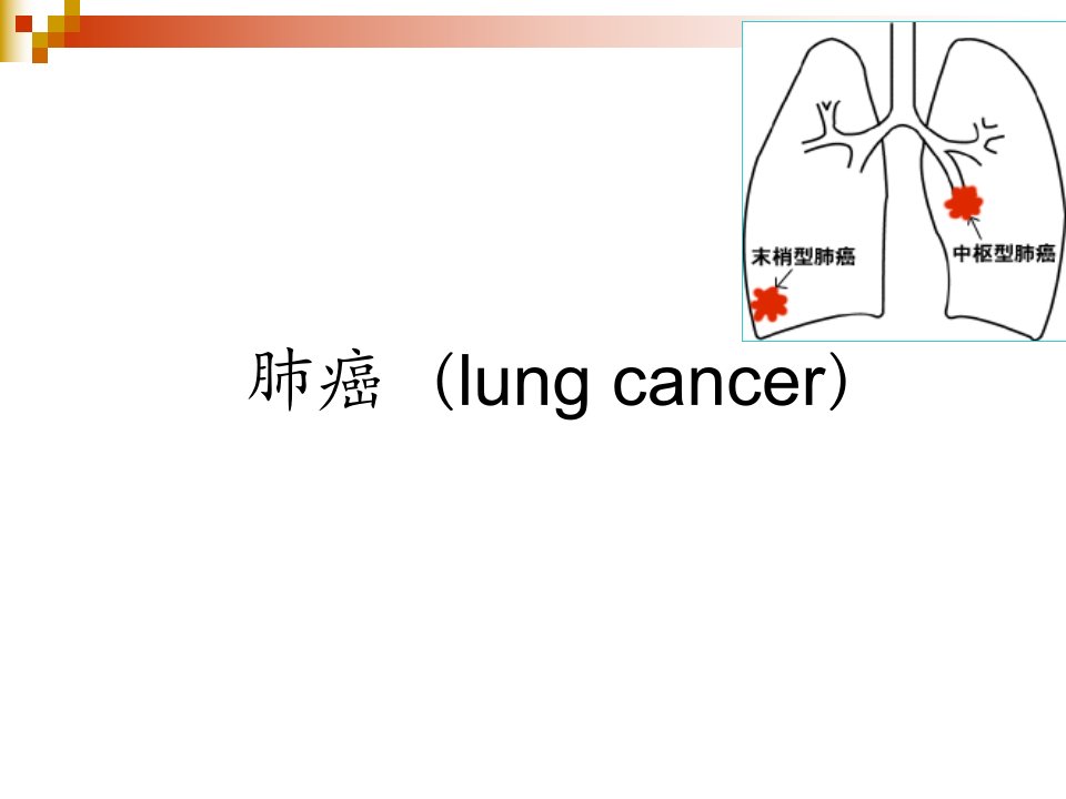 肺癌医学PPT课件