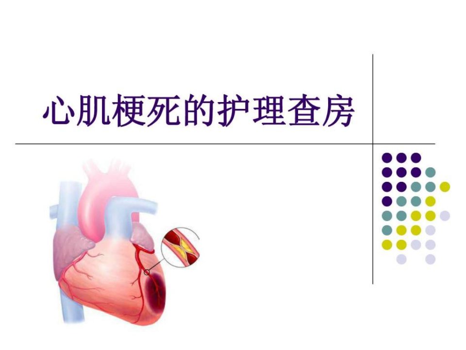 心肌梗死护理查房