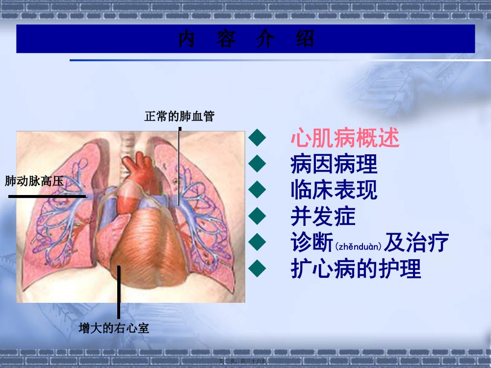 医学专题扩张型心肌病查房