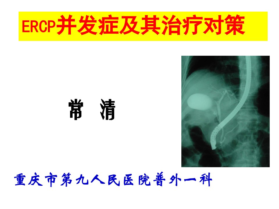 ERCP并发症