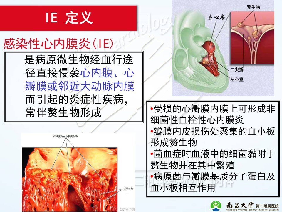 ESC感染性心内膜炎指南PPT课件