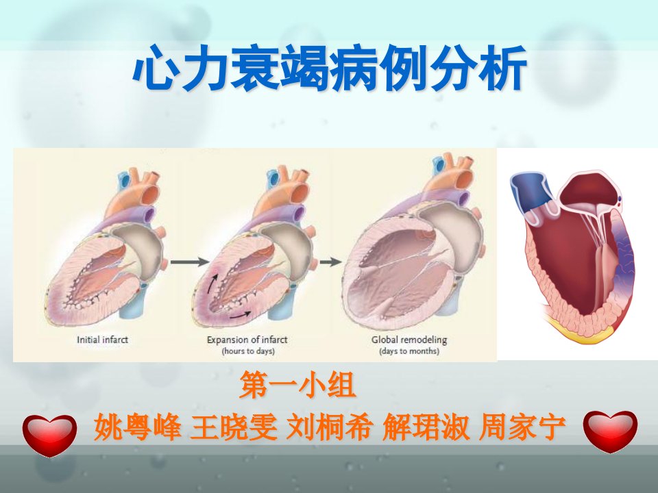 《心力衰竭病例分析》PPT课件