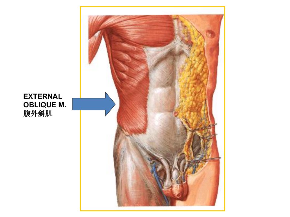疝-腹股沟疝解剖图谱