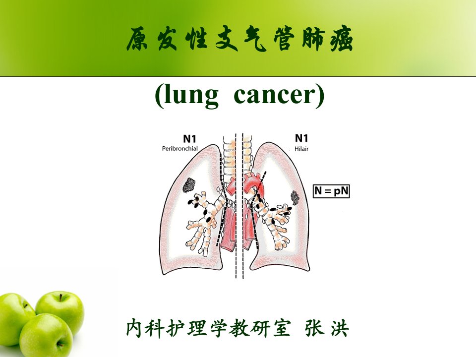 9原发性支气管肺癌