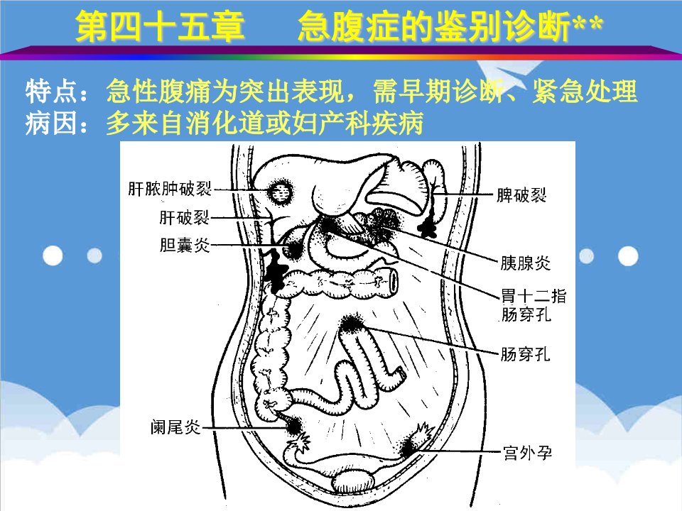 企业诊断-第四十五章急腹症的鉴别诊断