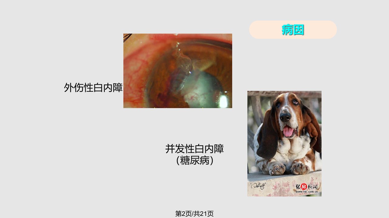 犬白内障诊治综述