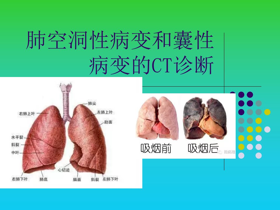 肺空洞性病变和囊性病变的CT诊断