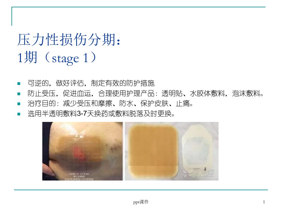 压力性损伤与失禁相关性皮炎ppt课件