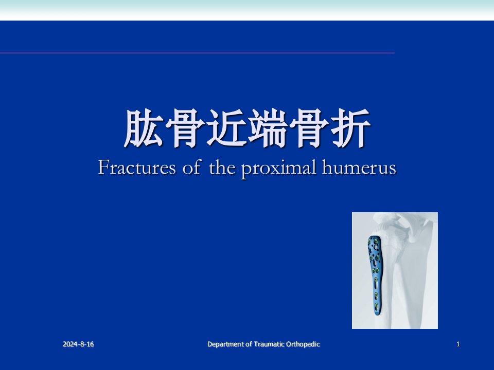 肱骨近端骨折PPT课件