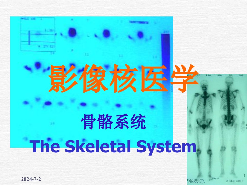 核医学骨骼系统