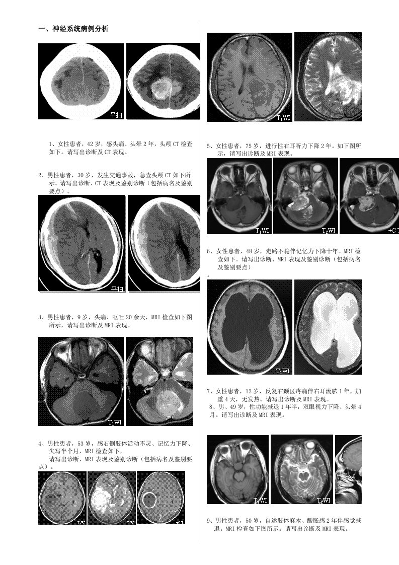 [医学]医学影像学典型病例分析含X、CT、MRI、DSA片