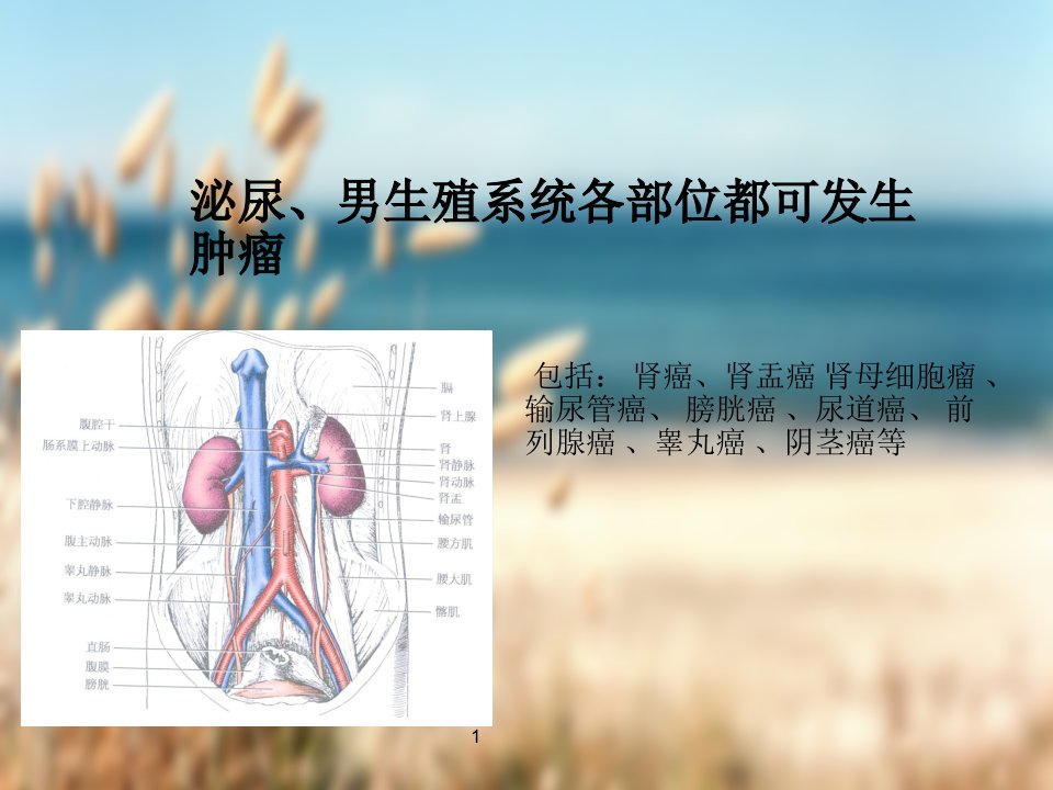 前列腺癌查房PPT课件