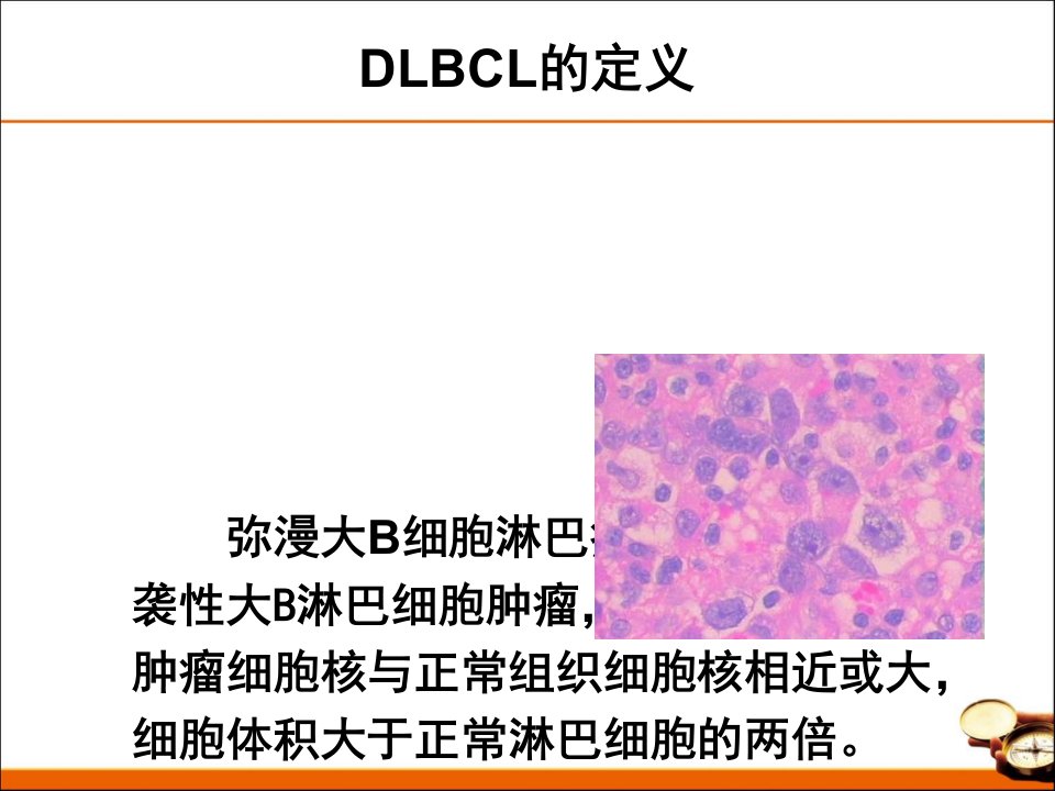 中国弥漫大b细胞淋巴瘤诊治指南教学提纲