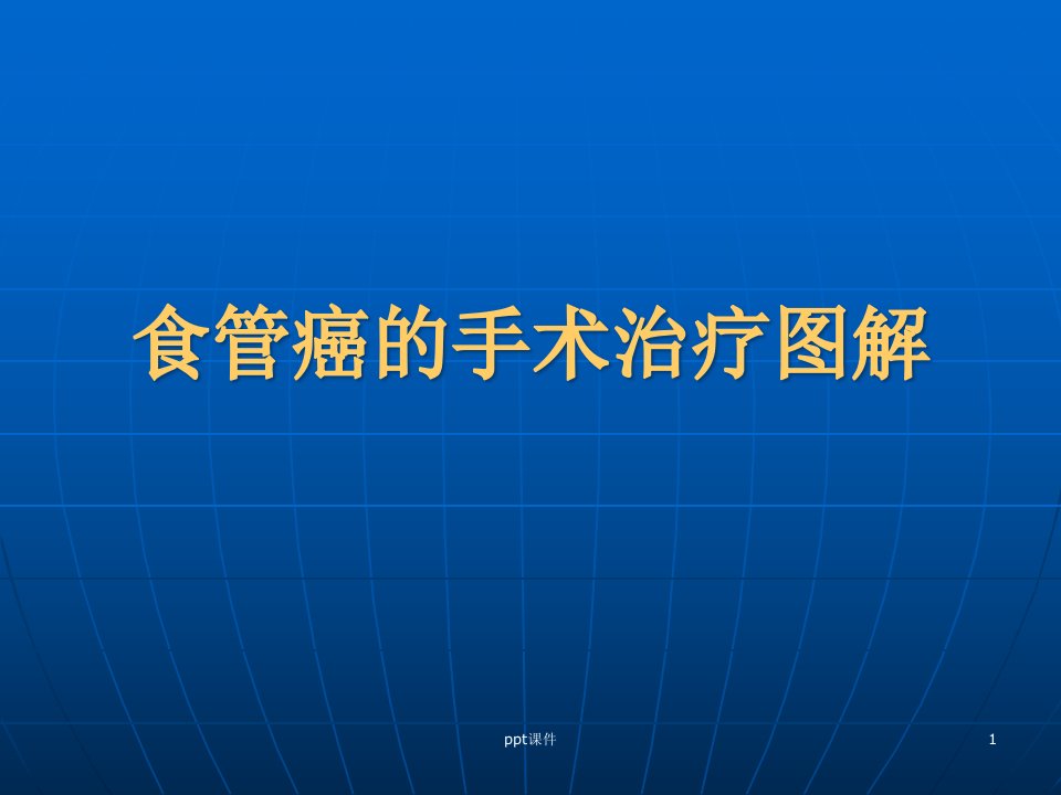 食管癌的手术治疗图解课件