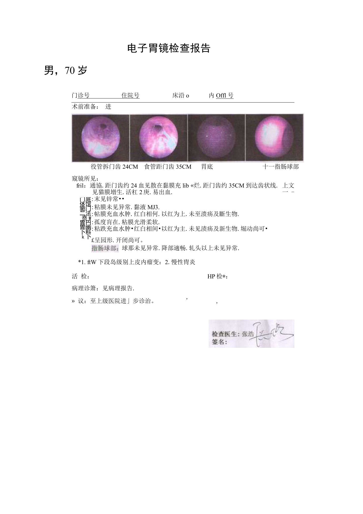 电子胃镜检查报告