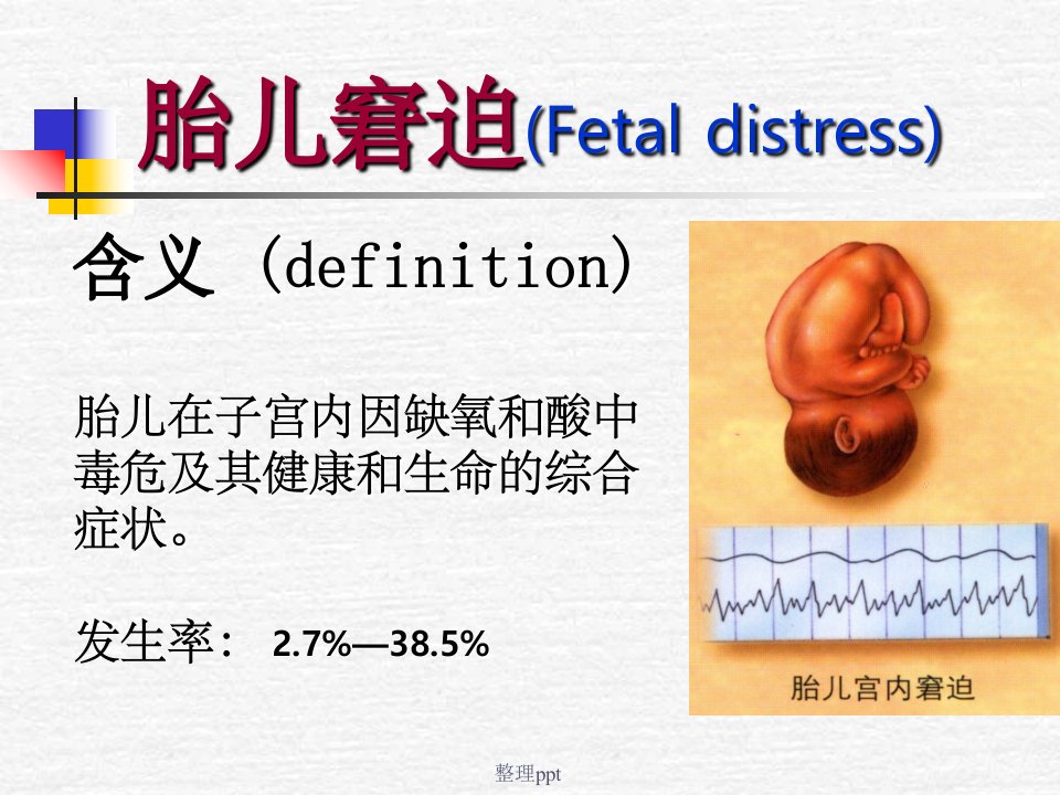 12.胎儿窘迫
