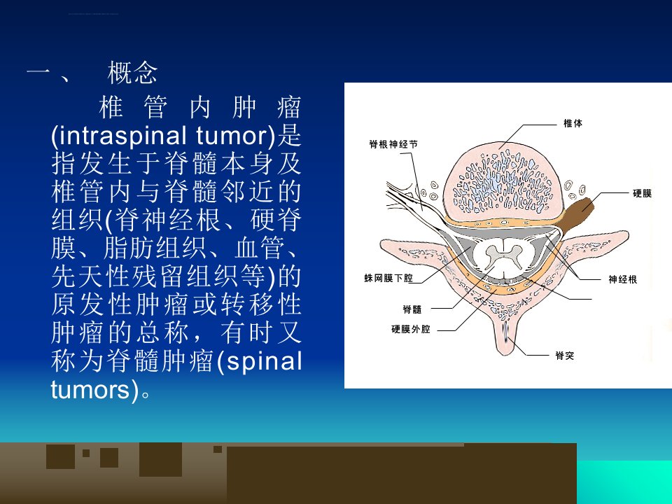 椎管内肿瘤课件ppt