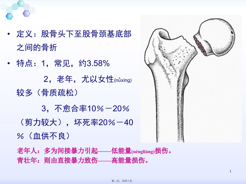 医学专题股骨颈骨折骨一科