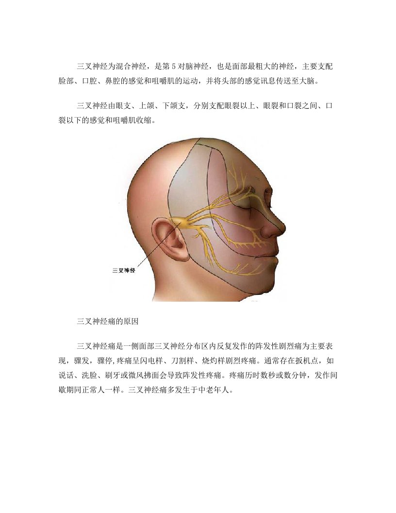 (图解)微血管减压手术治疗三叉神经痛的过程