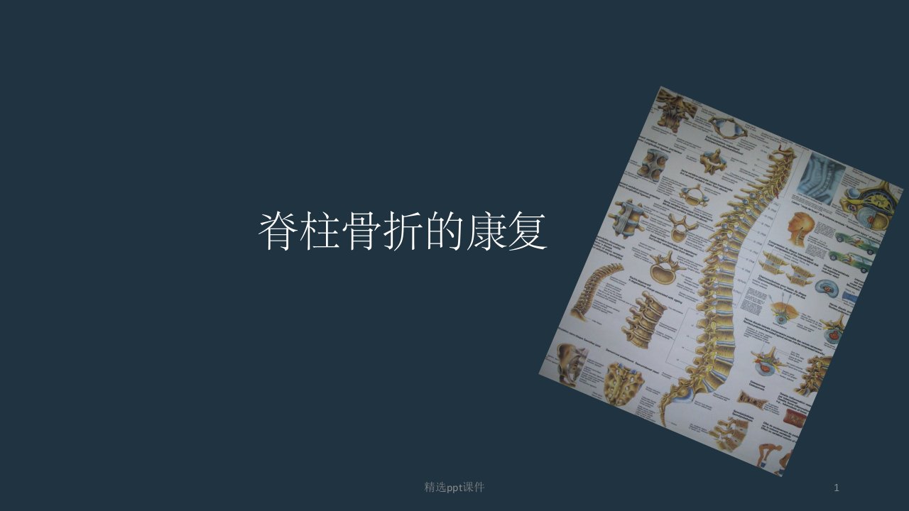 《脊柱骨折康复》PPT课件