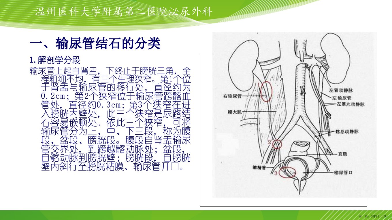 输尿管结石的微创治疗