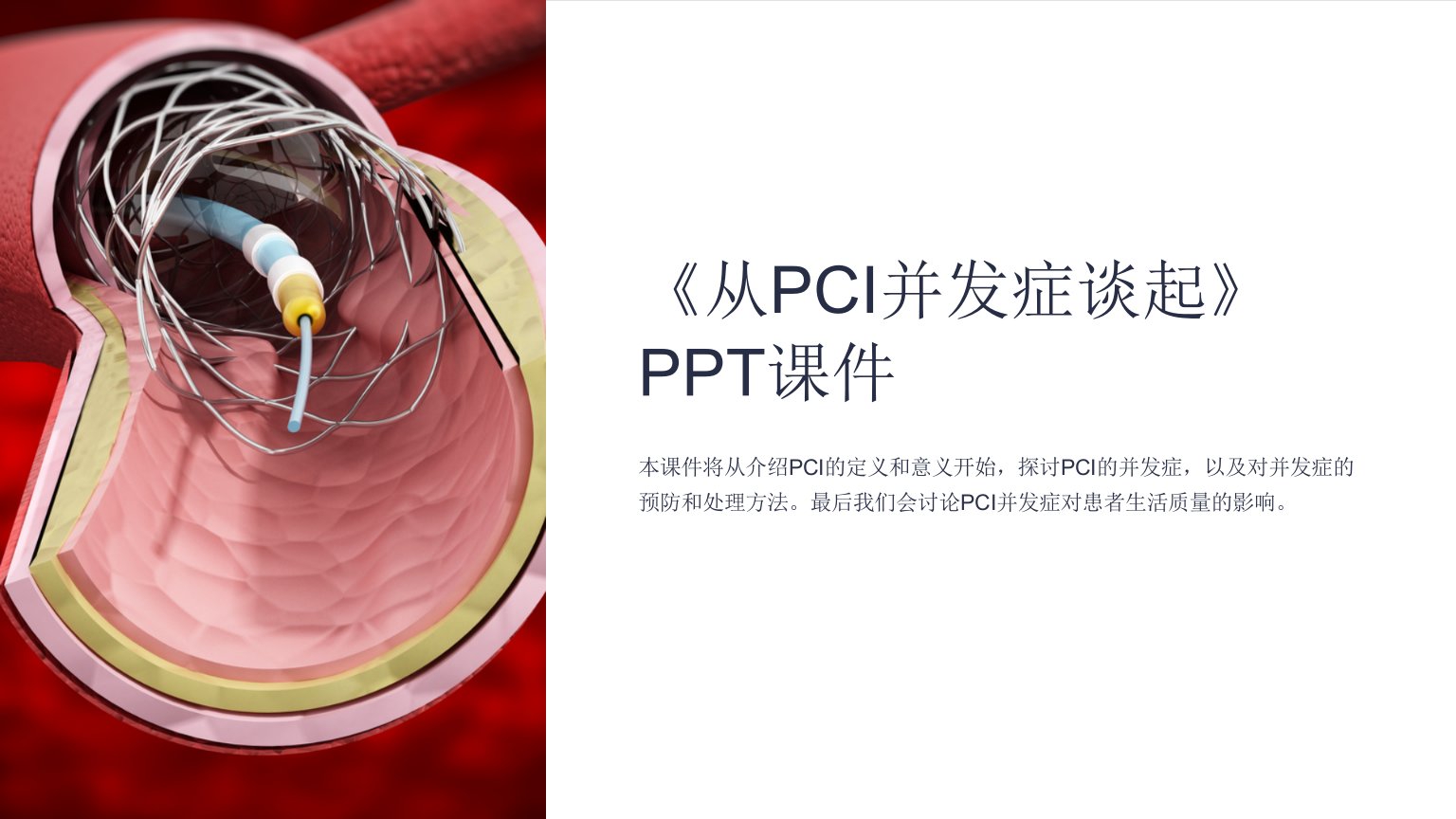 《从PCI并发症谈起》课件