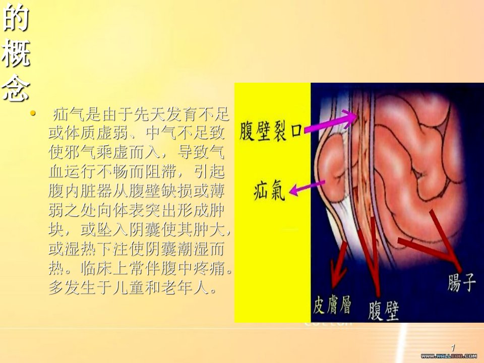 疝气的健康教育共10页