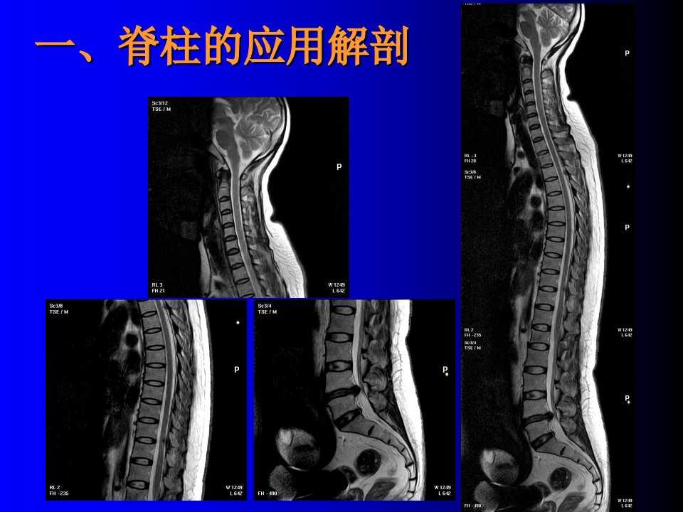 2021年脊柱CT扫描技术