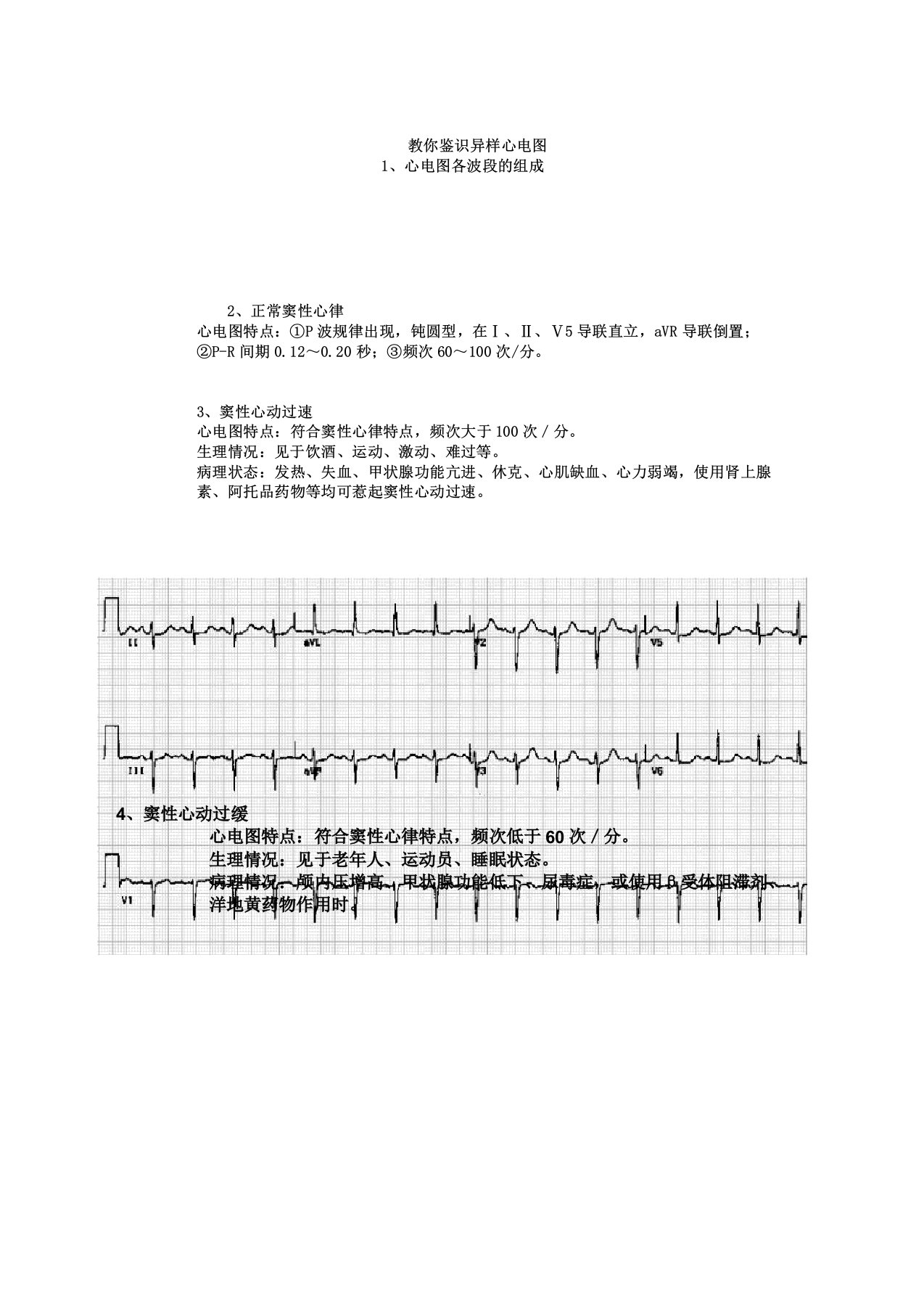 新教你识别异常心电图