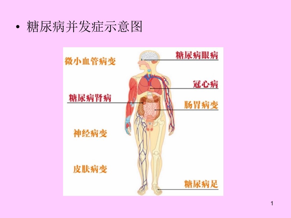 可怕的糖尿病并发症PPT课件