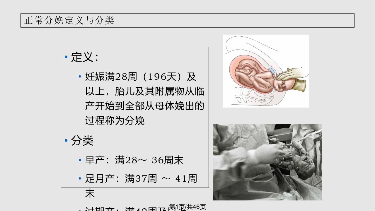 产程观察与处理PPT课件