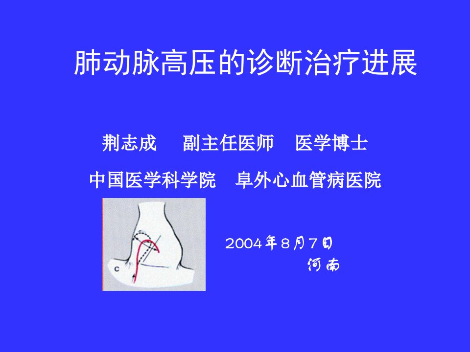 肺动脉高压的诊断和治疗-课件（PPT演示稿）