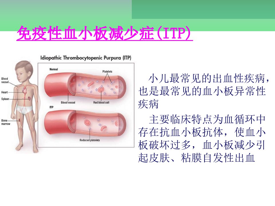 儿童免疫性血小板减少症的诊治教学文案