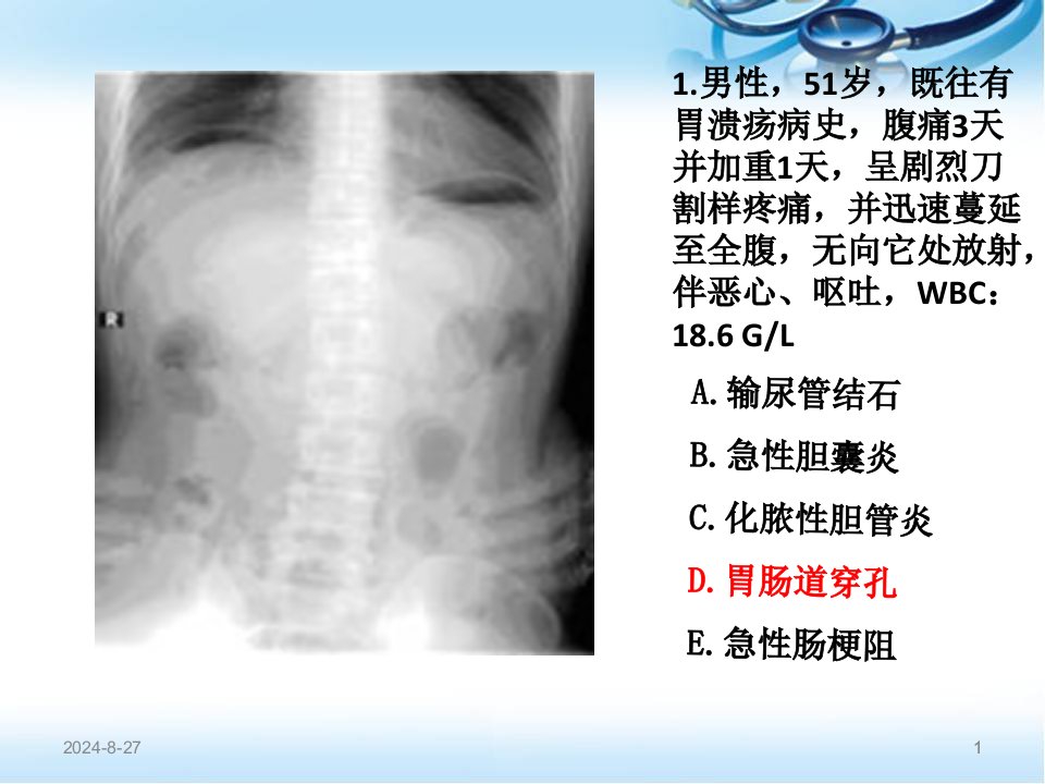 住院医师规陪出科考试辅助检查课件