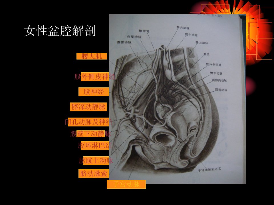 子宫肌瘤CT影像分析上课讲义