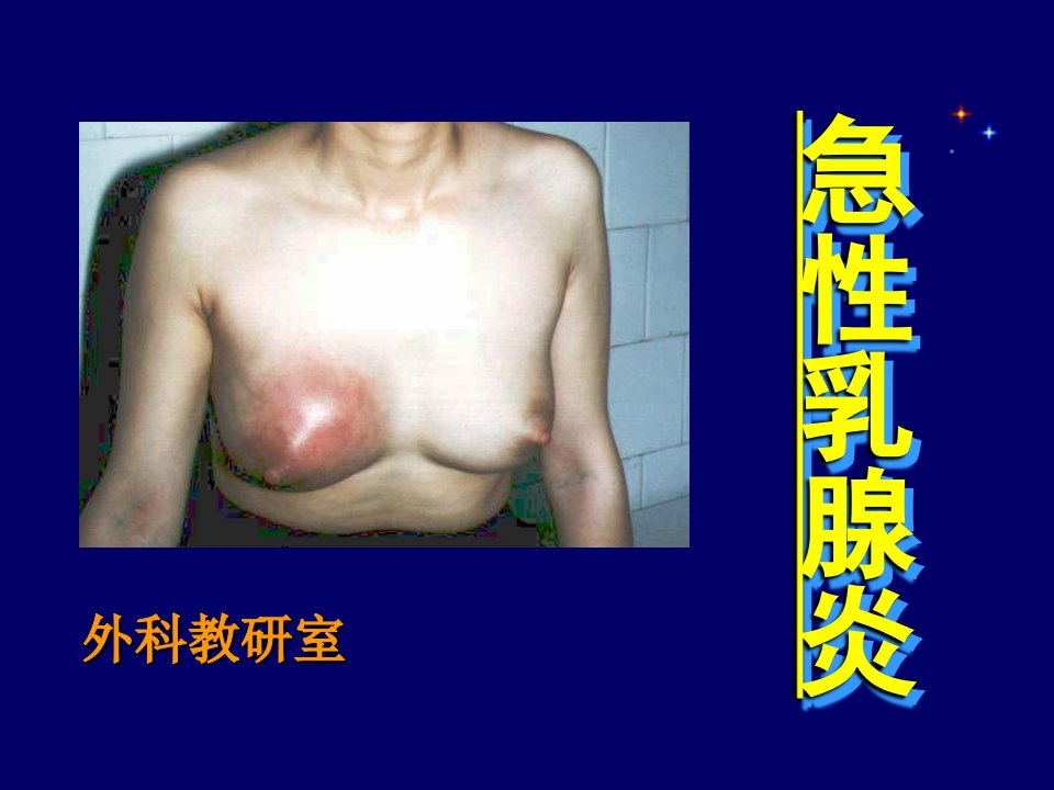 急性乳腺炎外科治疗课件