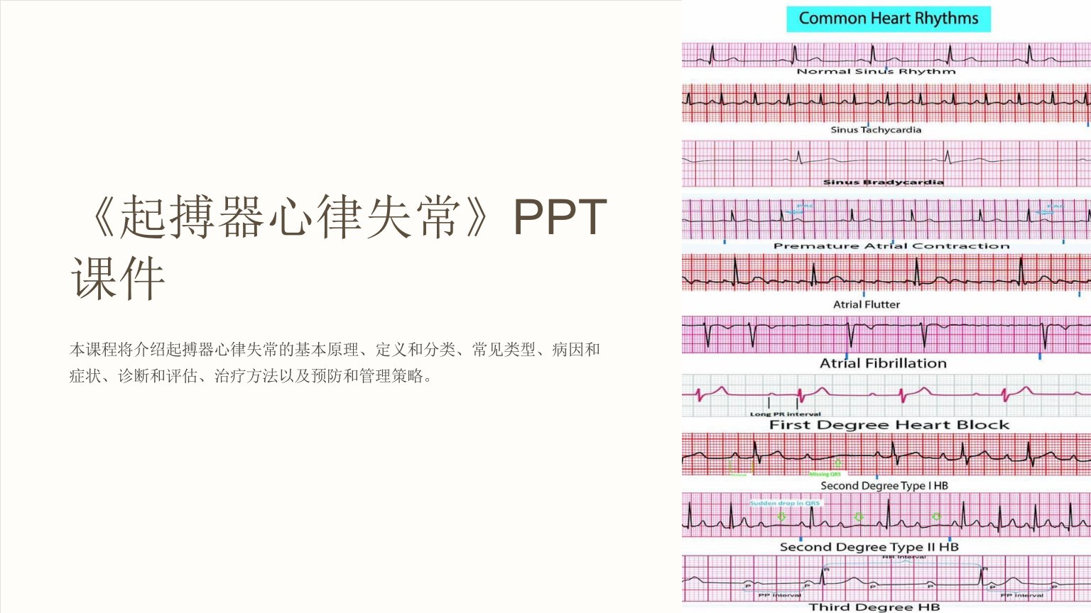 《起搏器心律失常》课件