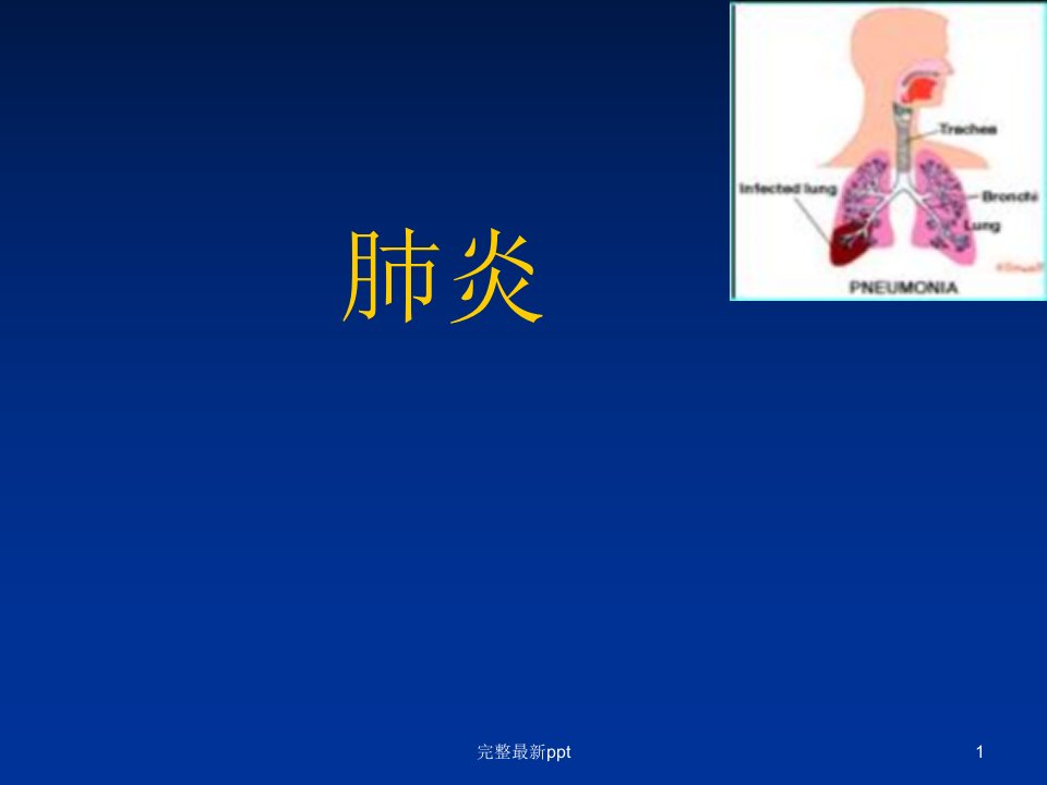 内科学--肺炎ppt课件