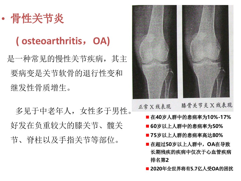从骨关节炎指南演变看NSAIDs在骨关节中的意义讲义
